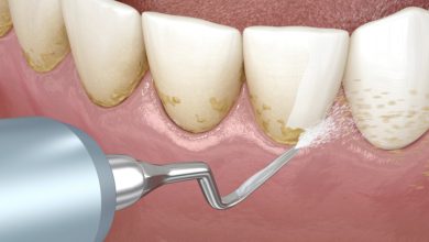 Photo of Значение регулярной гигиены полости рта